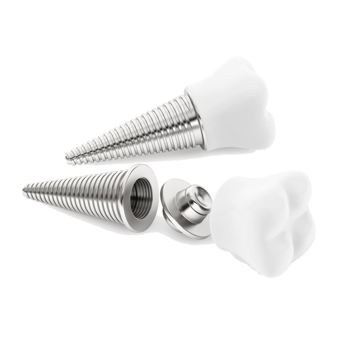 Implant Placement